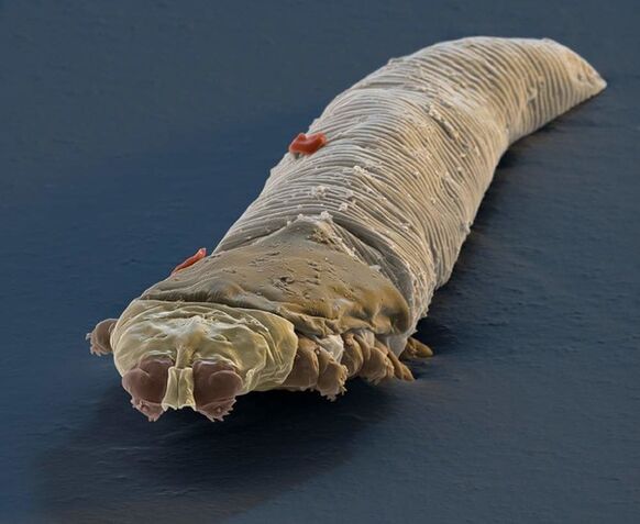 Demodikosia eragiten duen larruazalpeko parasitoa